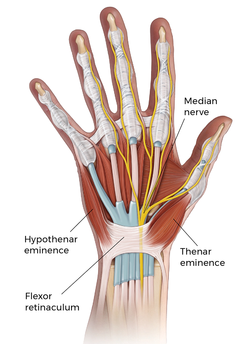 MA21_TheCarpalTunnel1