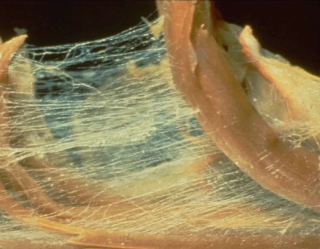 SO_16_LivingFascia_CottonCandy_Guimberteau_px1045