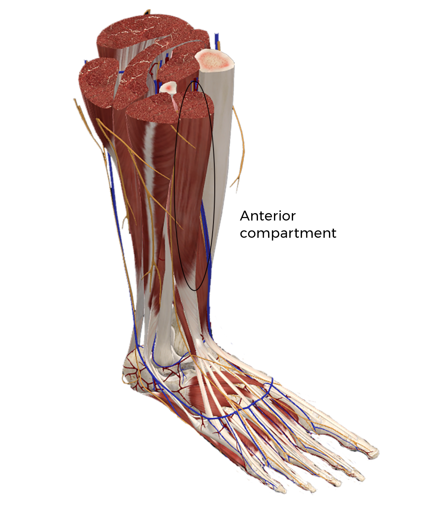 MA21_PuttingtheSqueeze2