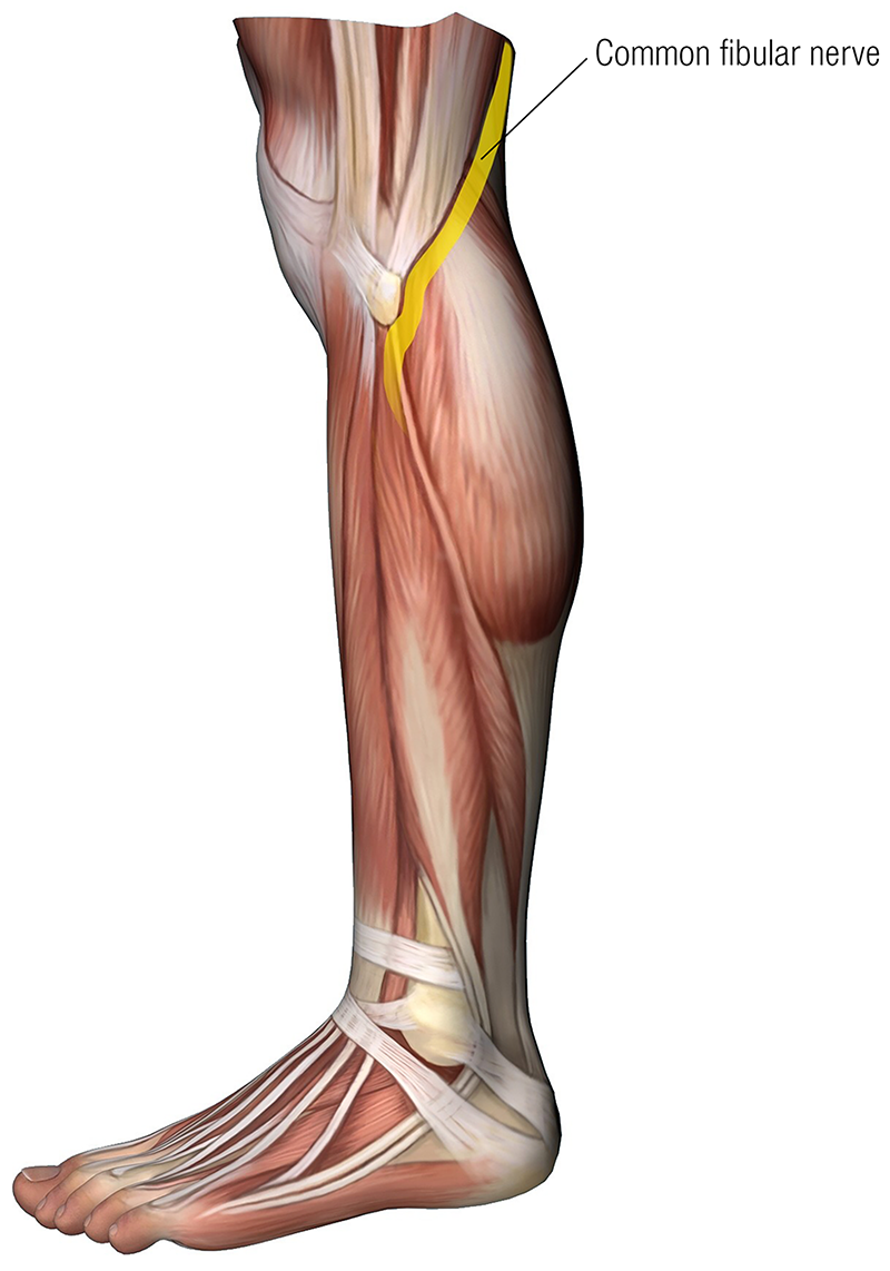 MJ20_Endangerment Sites10