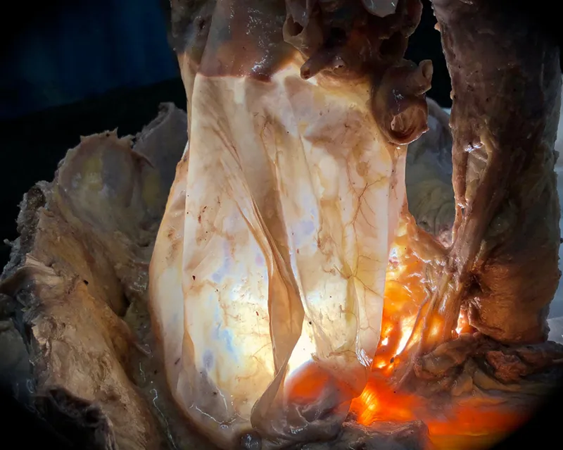 SO_18_HumanFascialPlastinationProject6_Pericardium_800