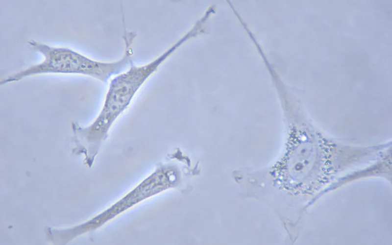 Zooming in on the fibroblast. Under a microscope, the fibroblast often appears spindle-shaped, but its shape isn’t static.