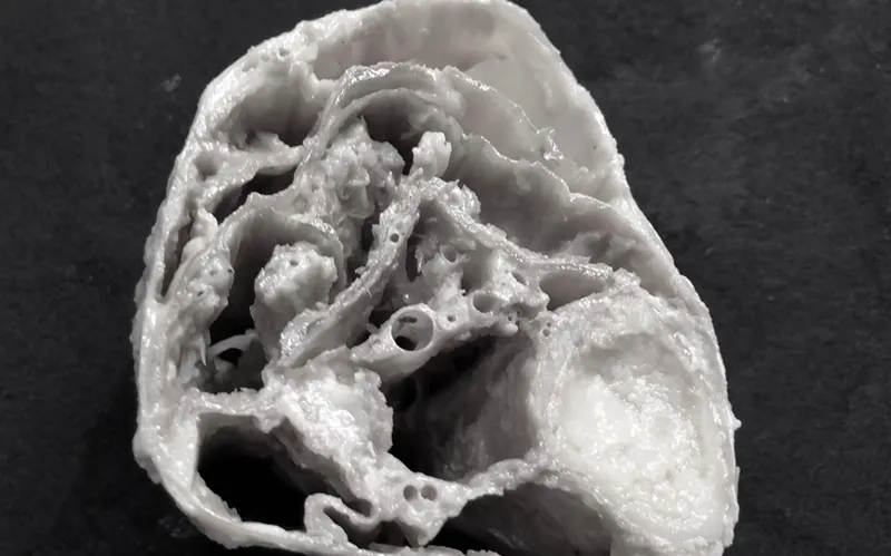 SO_18_HumanFascialPlastinationProject4_CrossSectionLeg_800