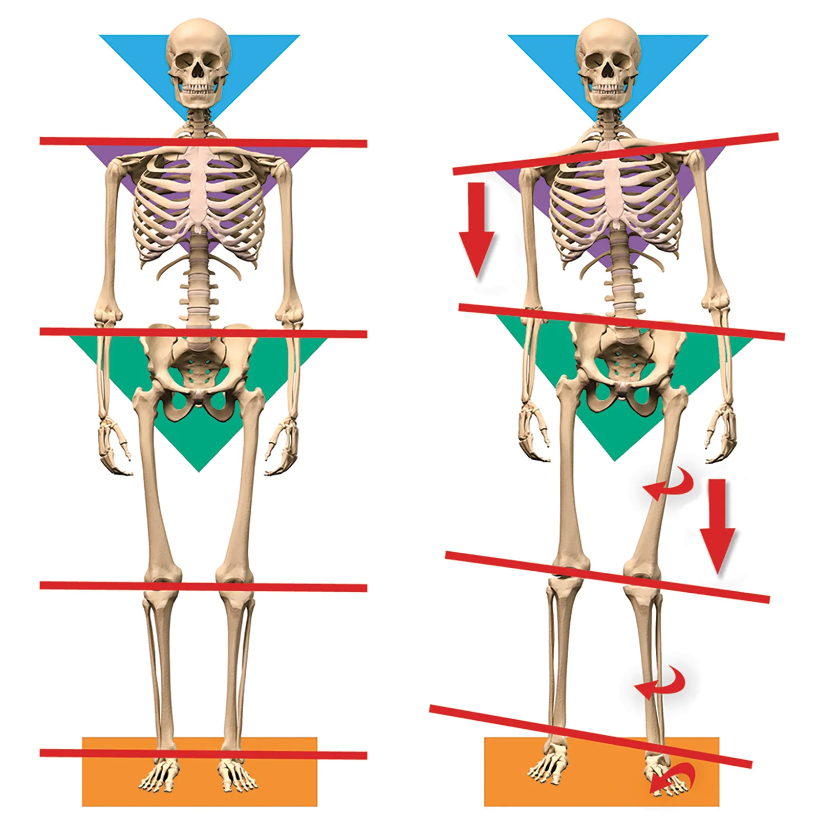 ND_14_Myoskeletal2_1600 ND_14_Myoskeletal2_1600