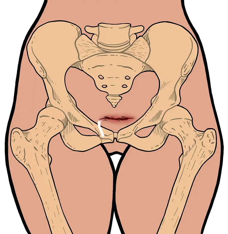 JF21_ResolvingWounds5