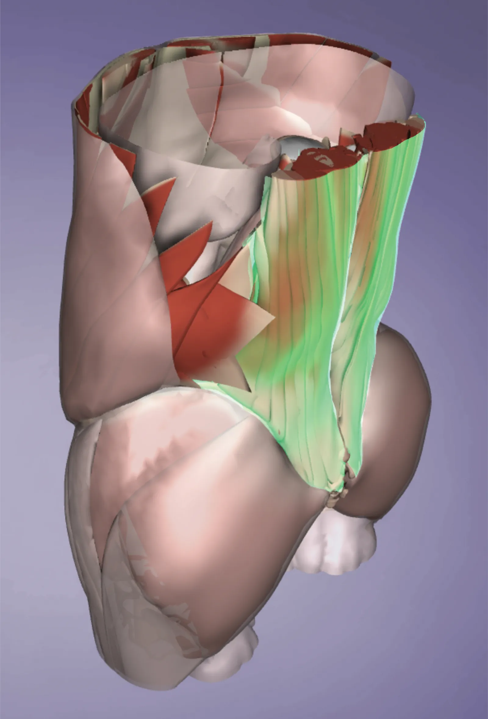 SO_14_Myofascial2_1600 SO_14_Myofascial2_1600