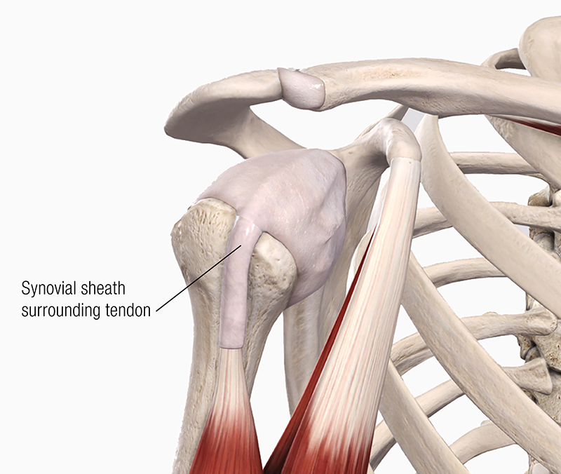 JA19_Bicipital Tendinopathy2